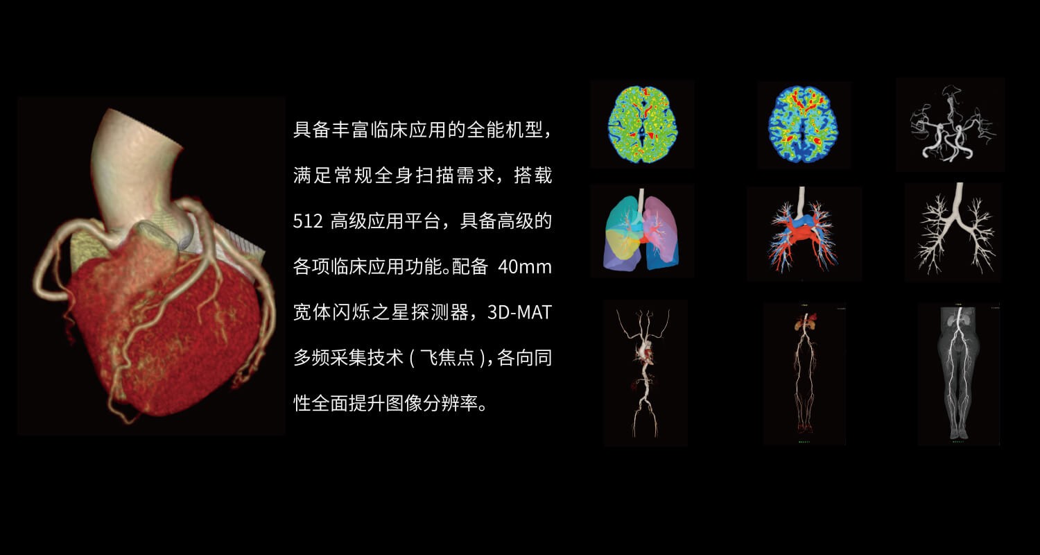 天域中高端CT系列